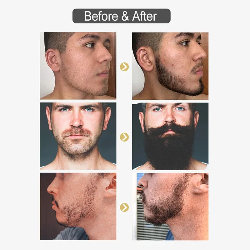 Thickener Nourishing Beard Oil