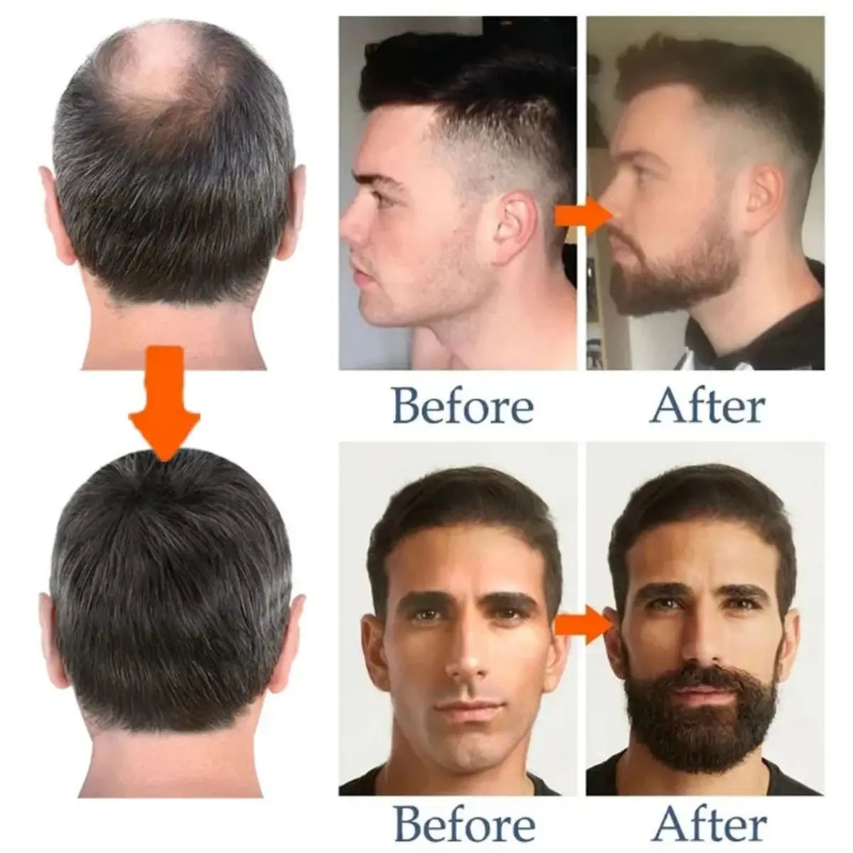 Beard Growth Natural Oil